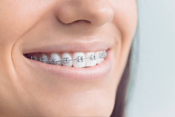 Best Traditional Braces  in Adrian, MI